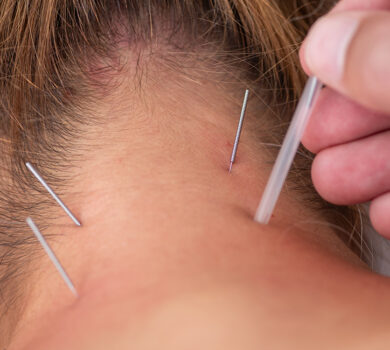 Dry Needling – What It Is, How It Works, and Who It Helps: If you've ever had a stubborn muscle knot that just won't quit, you know how frustrating it can be.